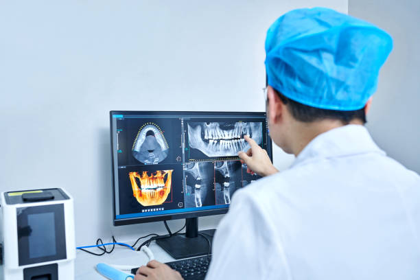 Best Emergency Wisdom Tooth Extraction in Frewsburg, NY